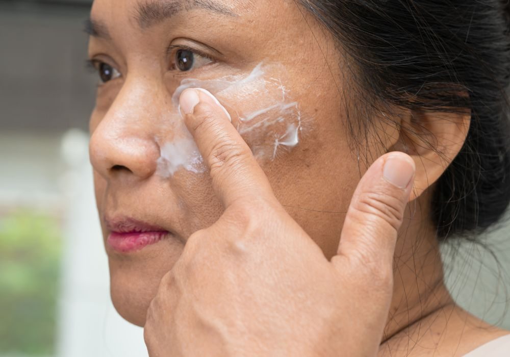Cuidados com o Tratamento do Melasma