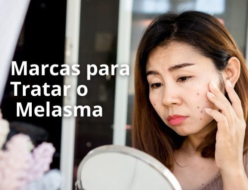 Marcas de Confiança para o Tratamento do Melasma