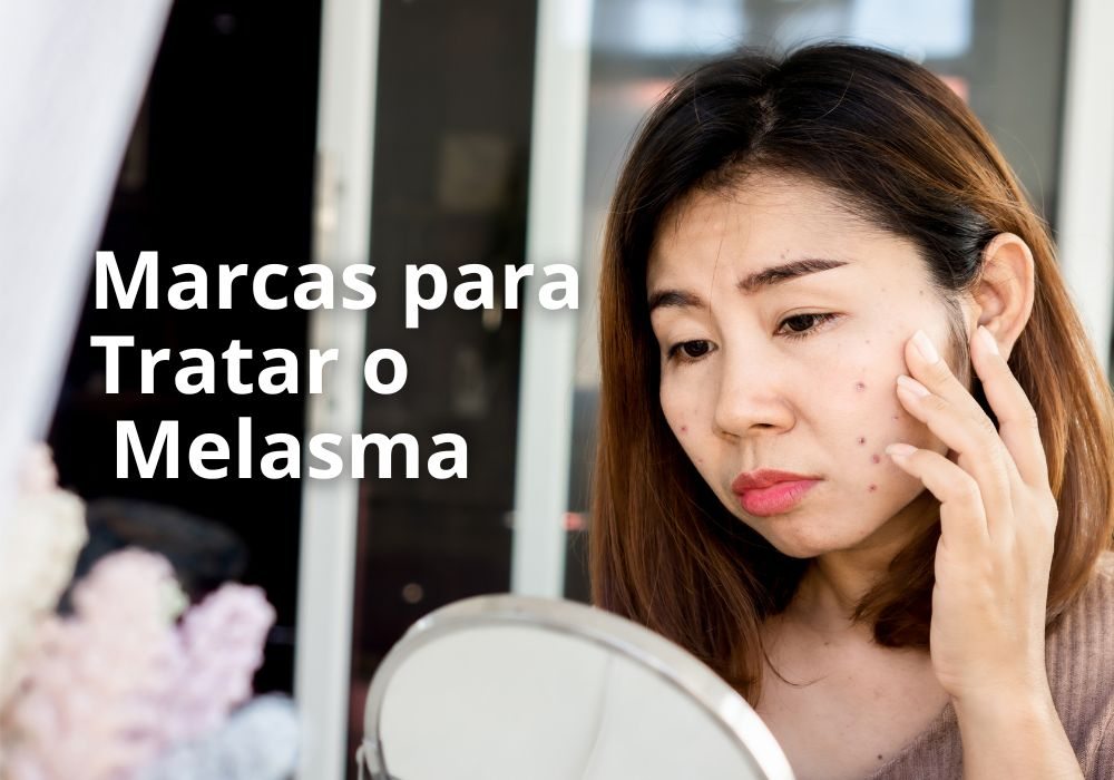Marcas de Confiança para o Tratamento do Melasma