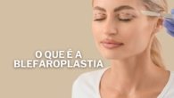 O que é Blefaroplastia Como funciona e Quanto custa esse Procedimento