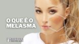 O Que é o Melasma Entenda Essa Condição de Pele Que Afeta Milhões de Pessoas