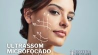 Quanto Custa o Ultrassom Microfocado (Ulthera ou Ultraformer)