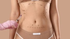 Quanto Custa a Abdominoplastia O que é e Como Funciona