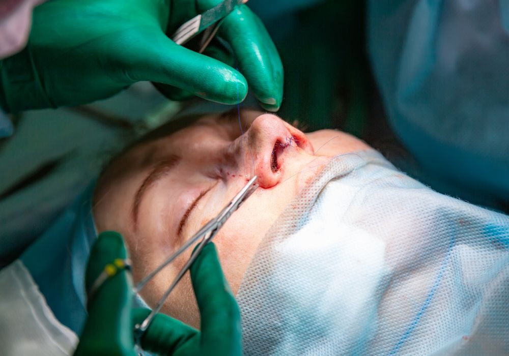 Quanto Custa a Rinoplastia