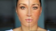Melhor Peeling para Manchas no Rosto Mais Eficaz Para a Sua Pele