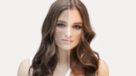 Qual o Melhor Sérum para Tratar Melasma