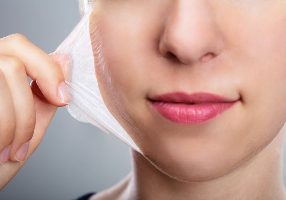 Quanto Custa Peeling Inteligente com Ação Controlada