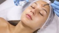 Tipos de Peelings e Quanto Custa em Média pra Renovar a Pele