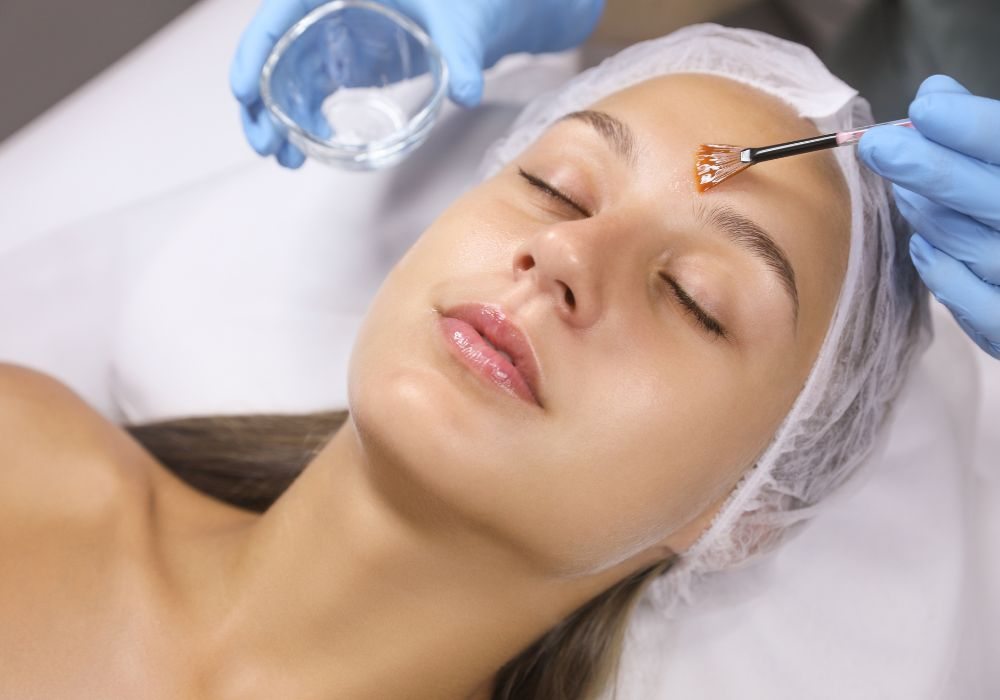 Tipos de Peelings e Quanto Custa em Média pra Renovar a Pele