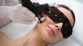 Laser Fracionado O Que É, Benefícios e Quanto Custa o Tratamento