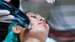 Microagulhamento Robótico com Radiofrequência Cicatrizes e Rejuvenescimento