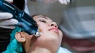 Microagulhamento Robótico com Radiofrequência Cicatrizes e Rejuvenescimento