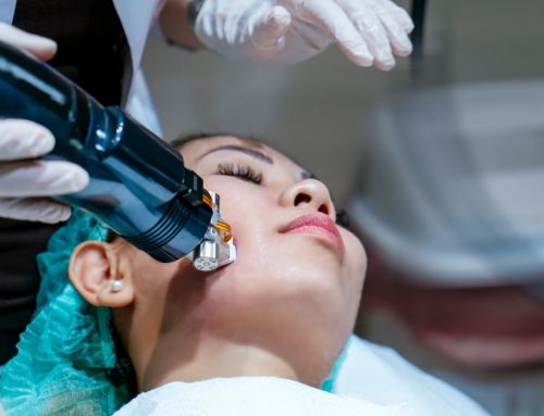 Microagulhamento Robótico com Radiofrequência: Cicatrizes e Rejuvenescimento