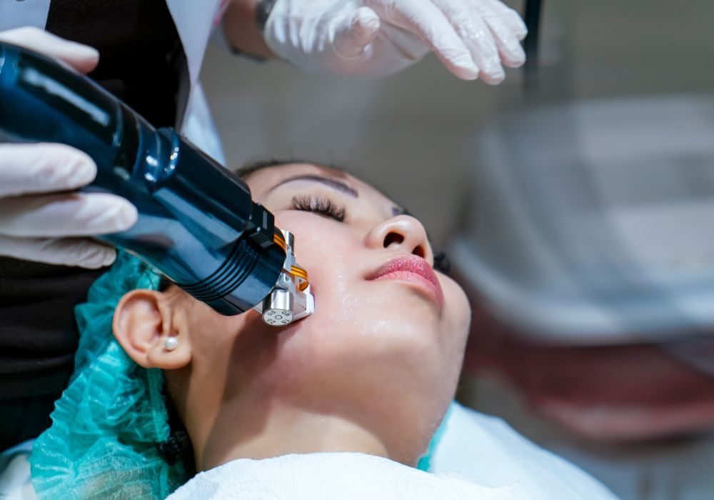 Microagulhamento Robótico com Radiofrequência Cicatrizes e Rejuvenescimento