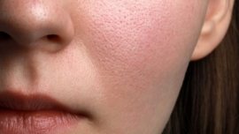 Rotina de Skincare para Peles Secas e Sensíveis Hidratação Profunda e Alívio