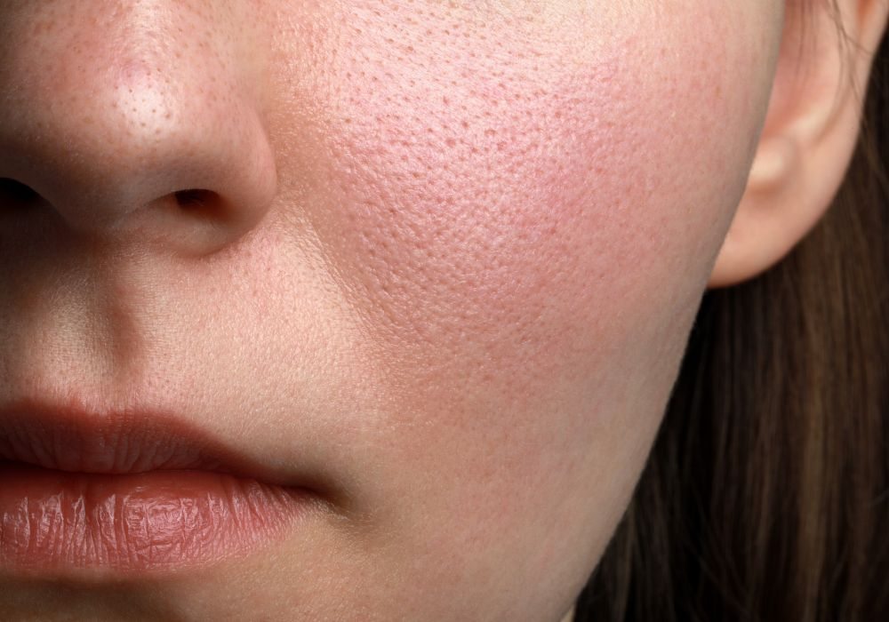 Rotina de Skincare para Peles Secas e Sensíveis Hidratação Profunda e Alívio