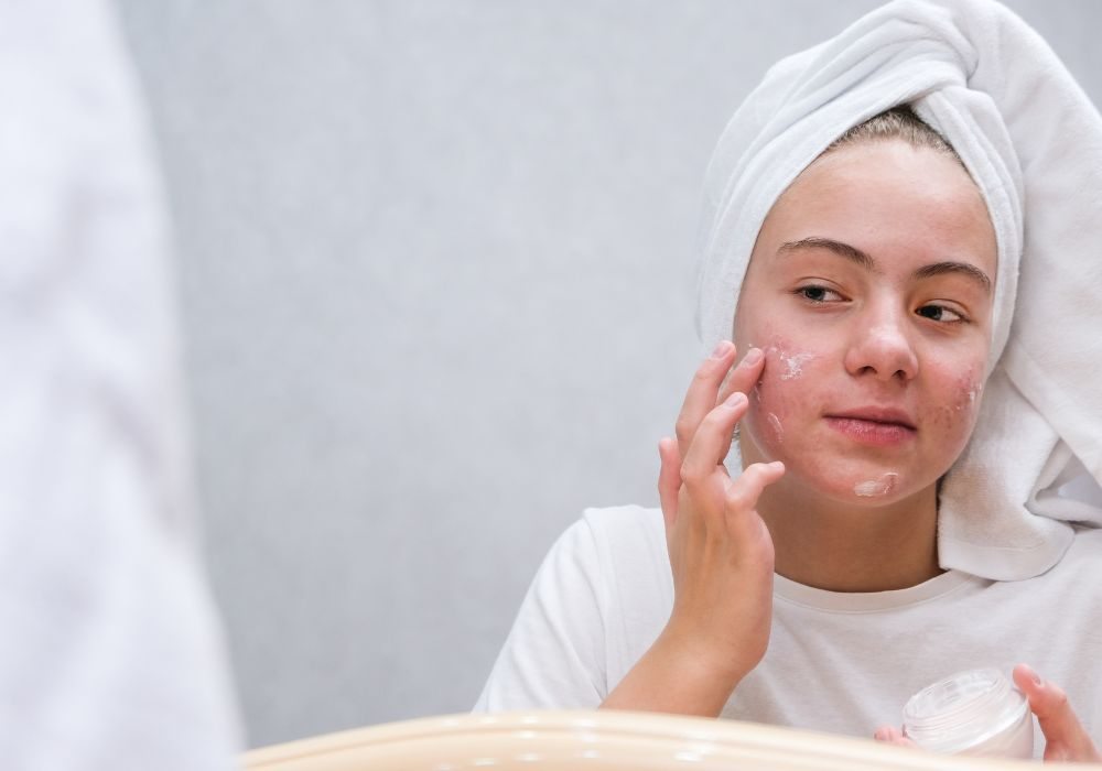 A Rotina de Skincare Essencial para Peles Oleosas e Acneicas