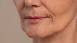 Qual o Melhor Tratamento para Bigode Chinês