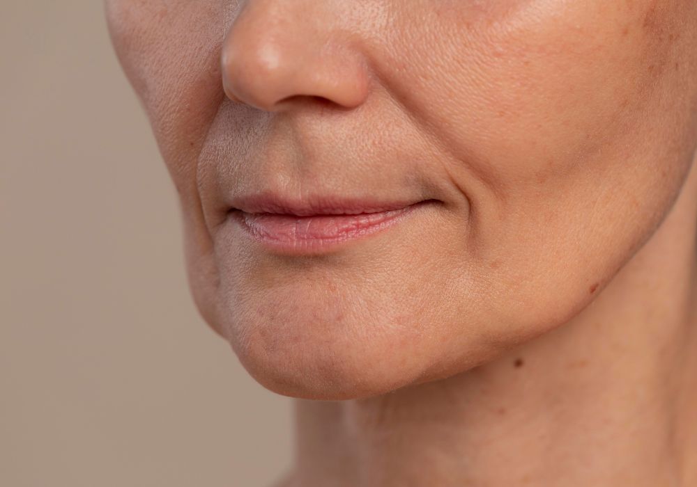 Qual o Melhor Tratamento para Bigode Chinês Qual o Melhor Tratamento para Bigode Chinês