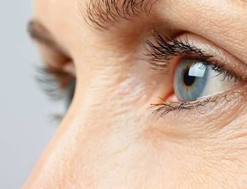 Melhores Produtos Para Tratar Rugas na Área dos Olhos